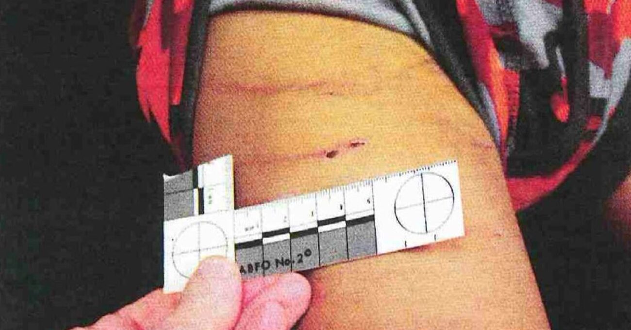 Adrian Peterson son's leg